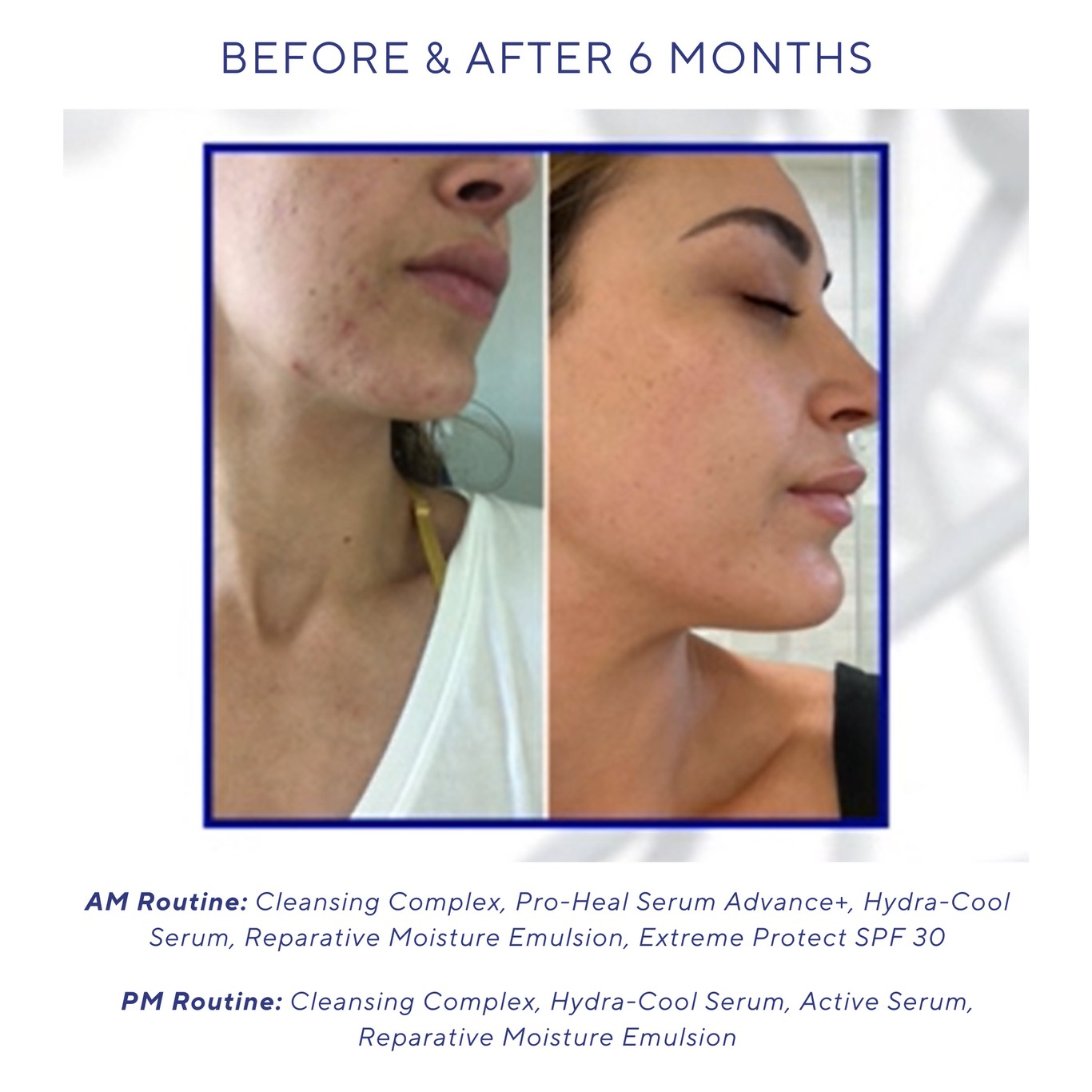 IS CLINICAL Сыворотка увлажняющая Hydra-Cool Serum, 15 мл 3