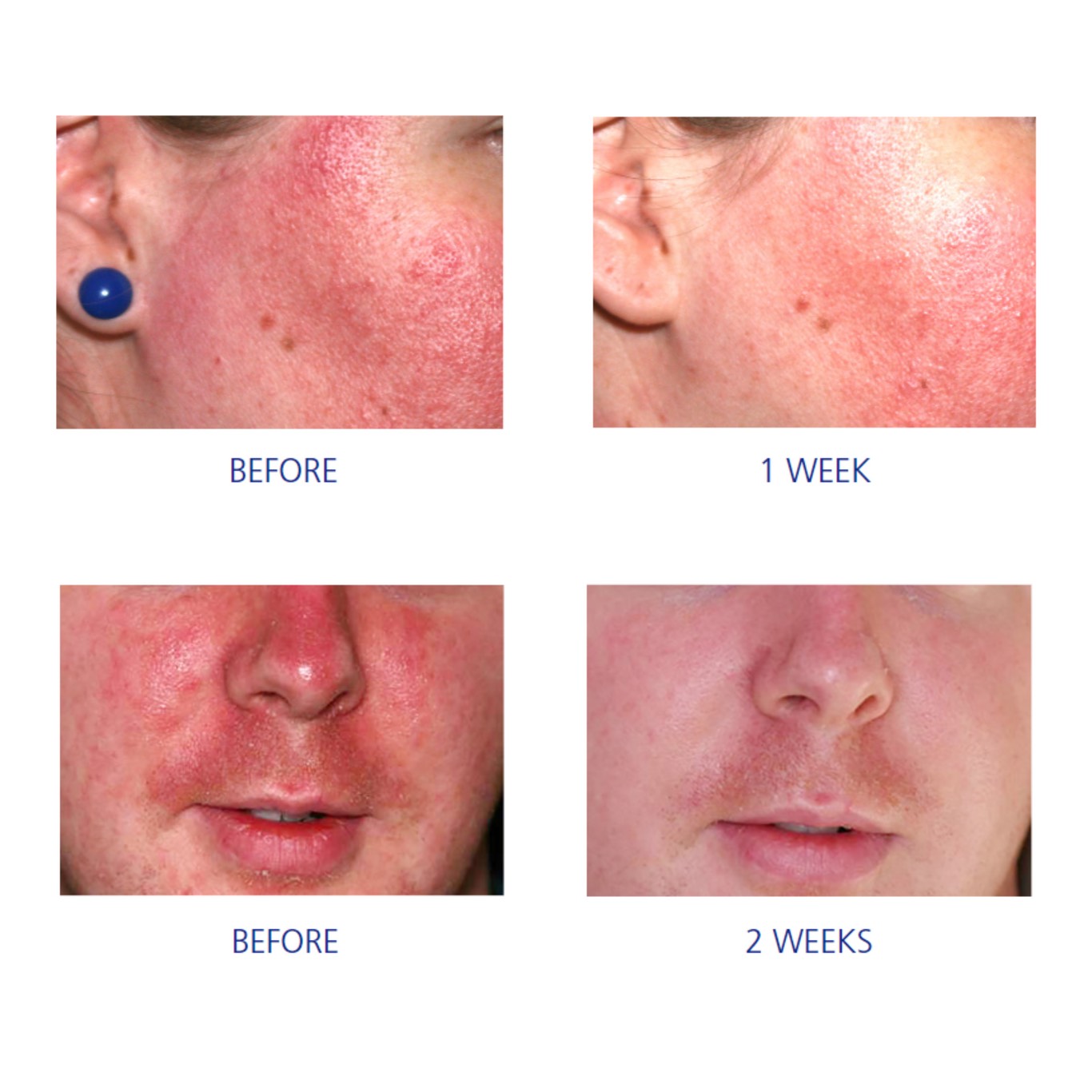 IS CLINICAL PRO-HEAL SERUM ADVANCE+  Сыворотка Про-Хил Серум Адванс (профессиональный объем 60 мл) 3