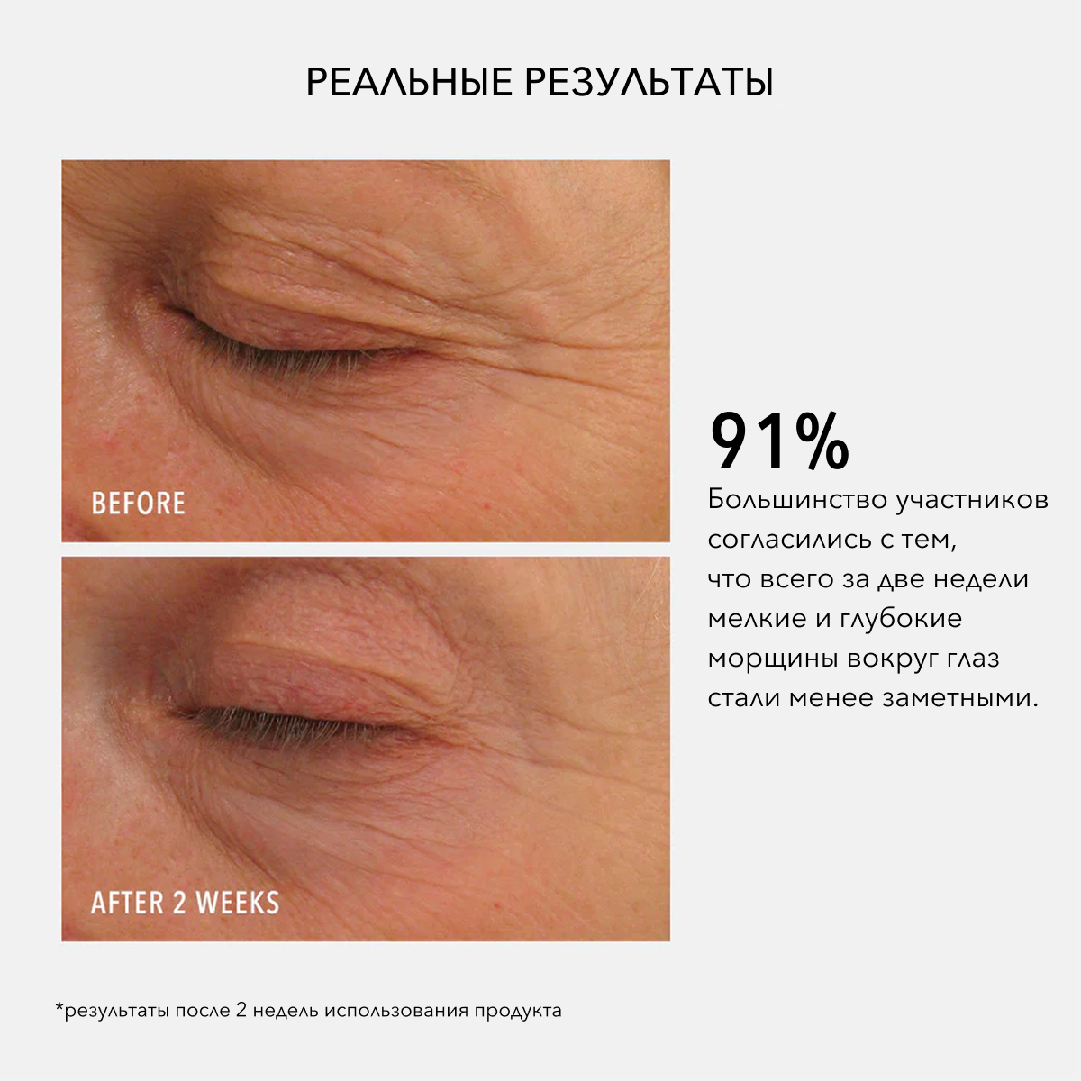 Hydropeptide EYE AUTHORITY, Увлажняющий крем для век против морщин, отеков и темных кругов под глазами, 15ml 2