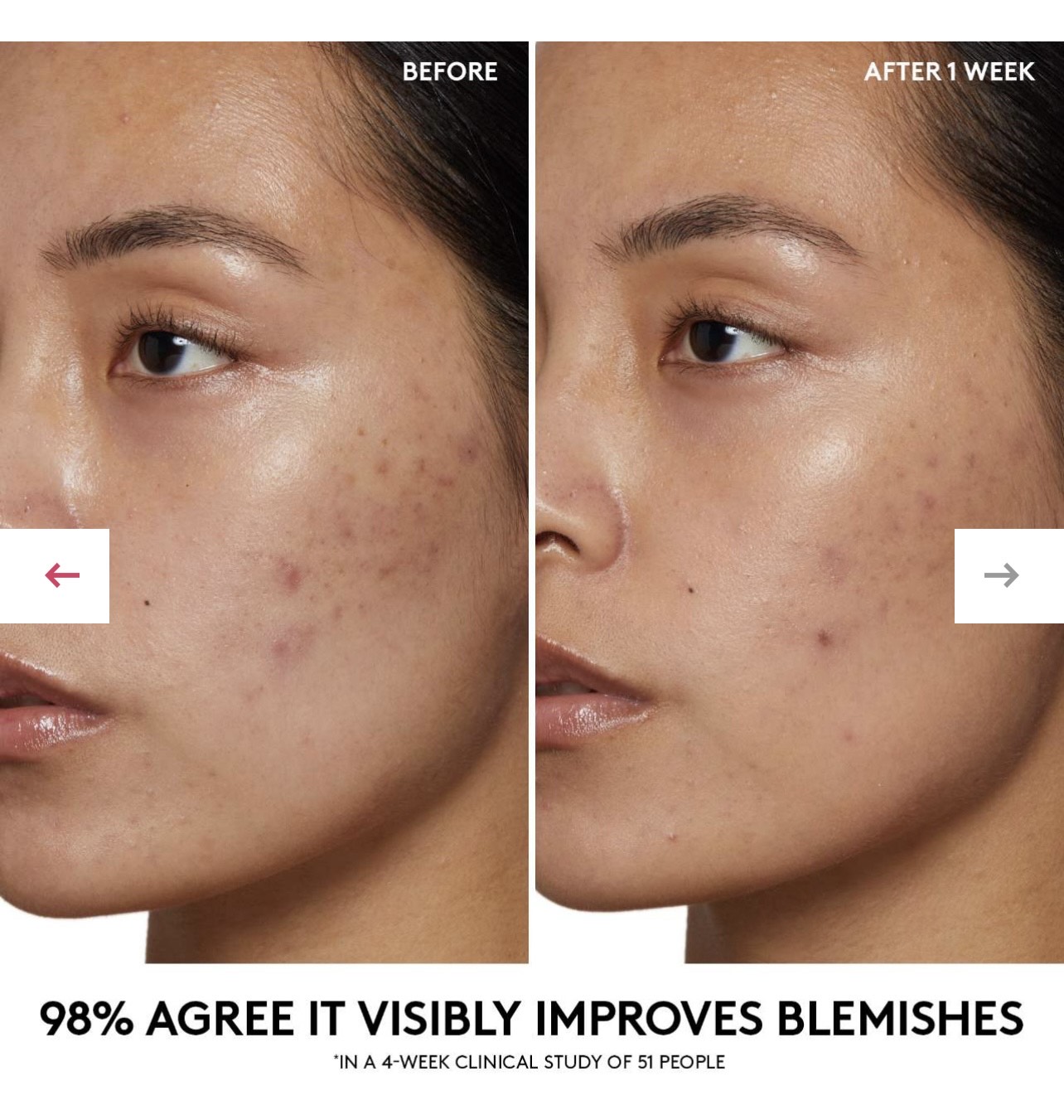 Fenty Beauty Средство для умывания Cherry Dub Pore Purify'r Gel Cleanser with Niacinamide + Aloe Juice, 185 мл 3